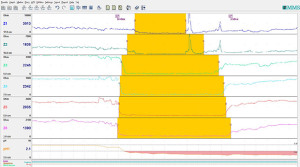 Oesophageal Impedance Test