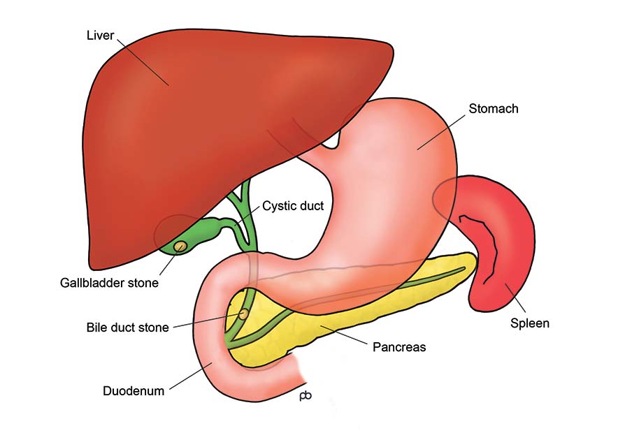 Do they do laparoscopic surgery if your liver levels are high?